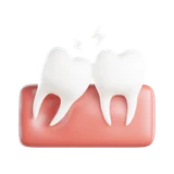 Wisdom Teeth
